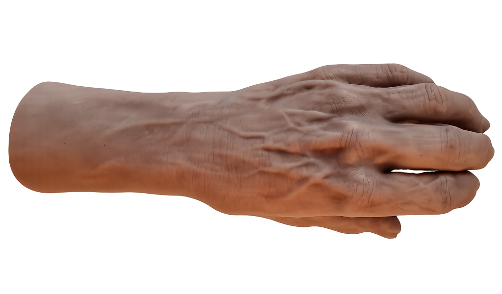 mano protesica presentazione dorso
