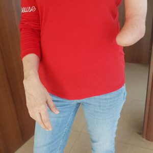 protesi di avambraccio