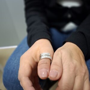 protesi di mano